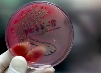 Sexually transmitted diseases that are increasing: gonorrhea, syphilis, monkeypox Sexually transmitted diseases that are increasing gonorrhea, syphilis, monkeypox