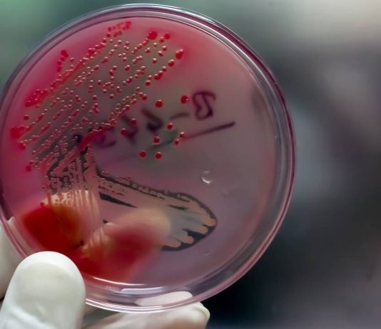 Sexually transmitted diseases that are increasing: gonorrhea, syphilis, monkeypox Sexually transmitted diseases that are increasing gonorrhea, syphilis, monkeypox