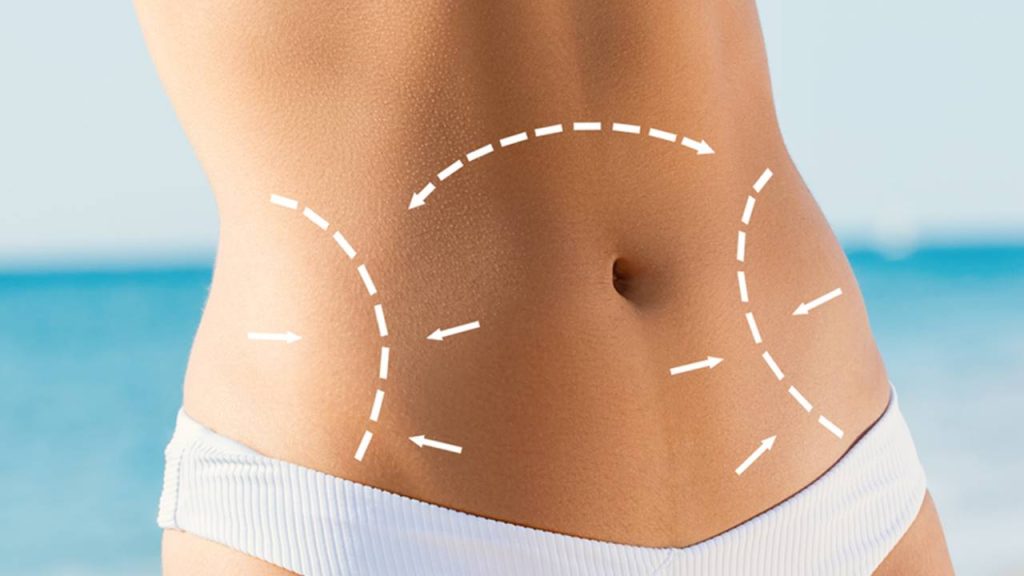 What is liposculpture and what are its dangers, risks and alternatives
