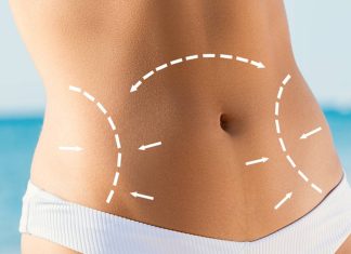 What is liposculpture and what are its dangers, risks and alternatives? What is liposculpture and what are its dangers, risks and alternatives
