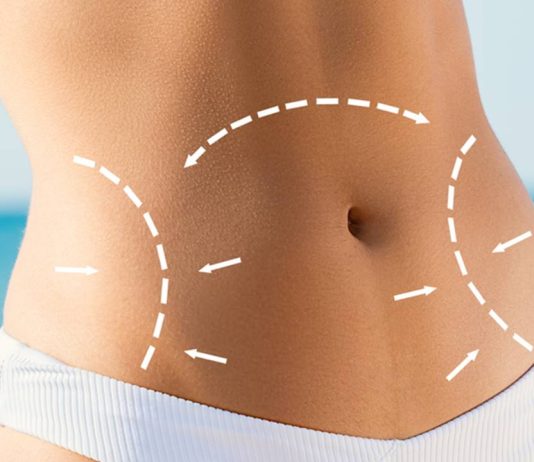 What is liposculpture and what are its dangers, risks and alternatives? What is liposculpture and what are its dangers, risks and alternatives